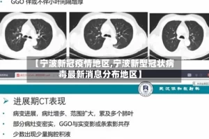 【宁波新冠疫情地区,宁波新型冠状病毒最新消息分布地区】