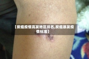 【炭疽疫情高发地区排名,炭疽暴发疫情标准】